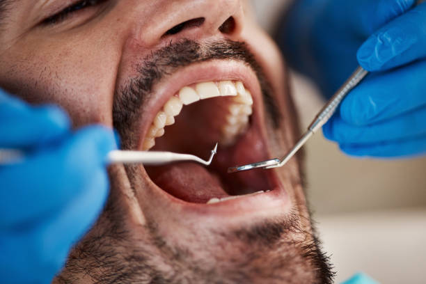 Best Dentist for Tooth Abscess  in Delphos, OH